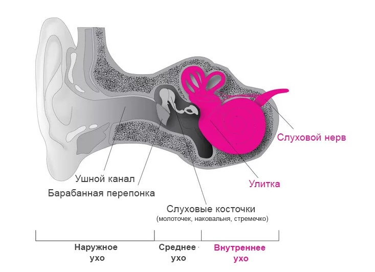 Тугоухость